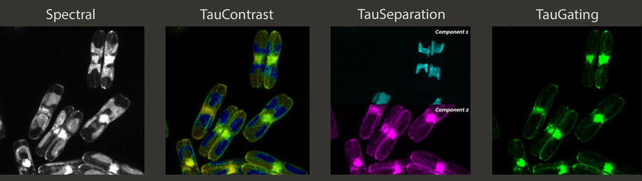 Diatoms examined with TauSense imaging tools.