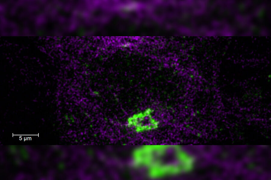 HeLa Kyoto cells. Courtesy of Dr. Juan Jung, EMBL, Heidelberg, Germany.