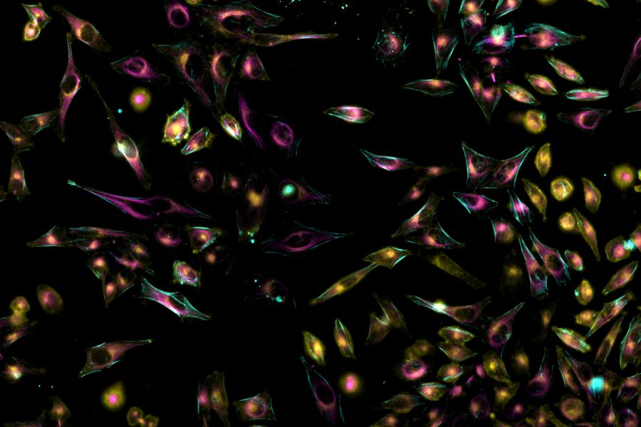 Live HeLa cells stained with WGA-488 (yellow), SPY-Actin (cyan), and SiR-Tubulin (magenta). Image was acquired using a Mica Microhub with Instant Computational Clearing (ICC) applied.