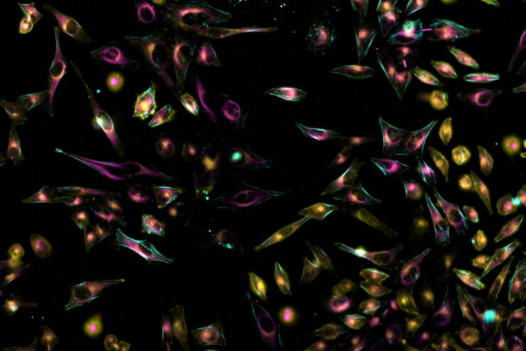 Living HeLa cells stained with WGA-488 (yellow), SPY-Actin (cyan), and SiR-Tubulin (magenta). Instant Computational Clearing (ICC) was applied. Living HeLa cells stained with WGA-488 (yellow), SPY-Actin (cyan), and SiR-Tubulin (magenta). Instant Computational Clearing (ICC) was applied.