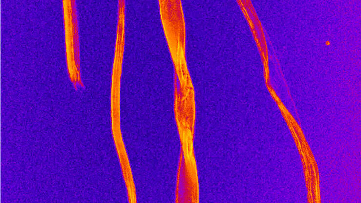 CARS image of cellulose fibers. The fibers are visualized through the C–H vibrations of the polyglucan chains in cellulose. CARS image of cellulose fibers. The fibers are visualized through the C–H vibrations of the polyglucan chains in cellulose.