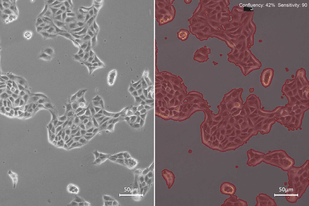Phase-contrast image of a MDCK-cell culture and its respective confluency measured by the Mateo TL microscope. Phase-contrast_image_of_a_MDCK-cell_culture_respective_confluency_Mateo_TL.jpg