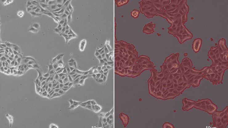 [Translate to chinese:] Phase-contrast image of a MDCK-cell culture and its respective confluency measured by the Mateo TL microscope.