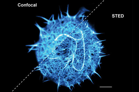 悬浮的活 T 细胞。共焦和 STED 堆积的 3D 重建。