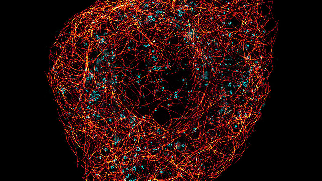 TauSTED 775 resolves the intricate cytoskeleton network labeled with SiR-tubulin (glow - Spyrochrome), and trafficking vesicles labeled with CF594 (cyan - Biotium). Intricate_cytoskeleton_network_and_trafficking_vesicles_in_live_cell.jpg