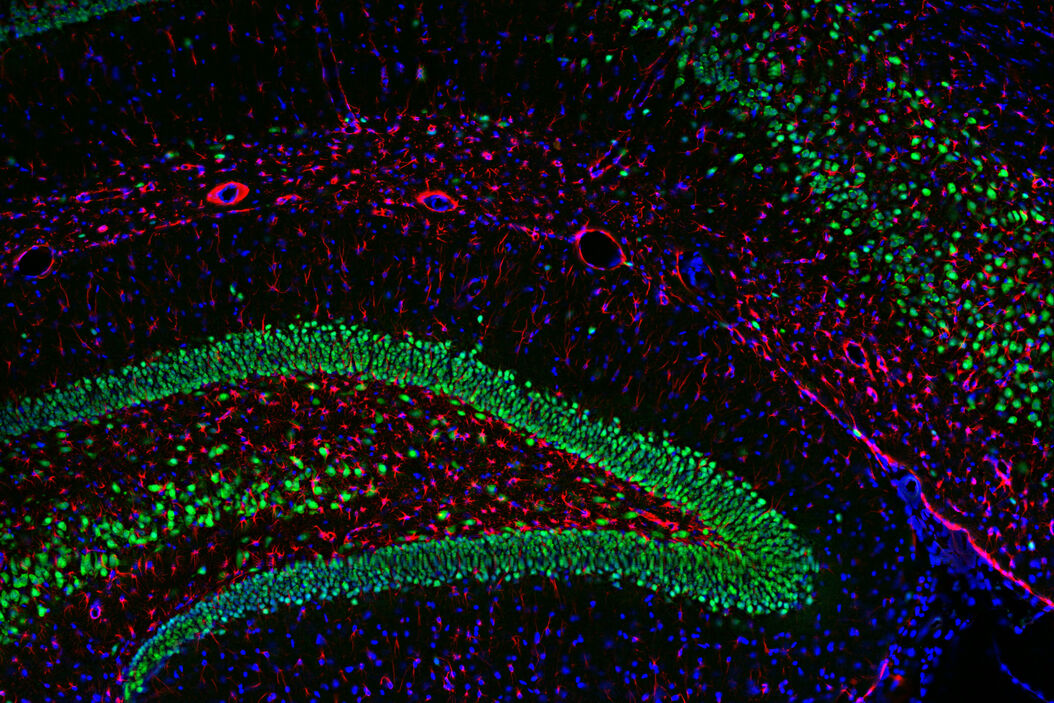 Image: Adult rat brain. Neurons (Alexa Fluor488, green), Astrocytes (GFAP, red), Nuclei (DAPI, blue). Image courtesy of Prof. En Xu, Institute of Neurosciences and Department of Neurology of the Second Affiliated Hospital of Guangzhou Medical University, China. Multicolor_microscopy_The_importance_of_Multiplexing_teaser.jpg