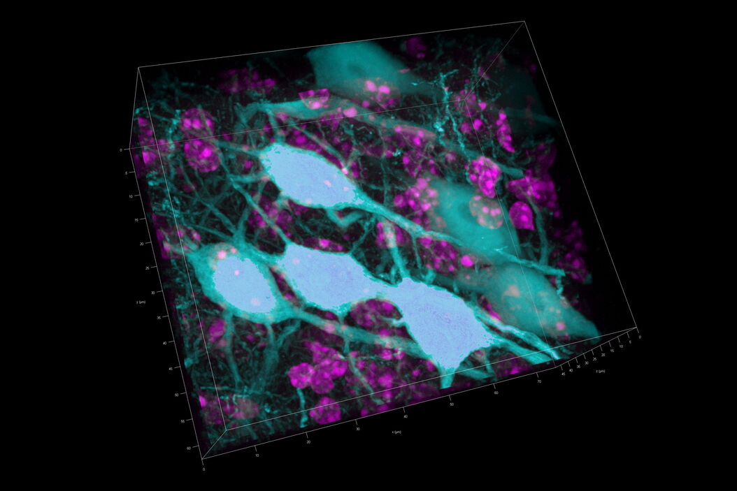 [Translate to chinese:] 3D Reconstruction of brain slide image_Mica Brain_slide_image_3D_Reconstruction_Mica_teaser.jpg