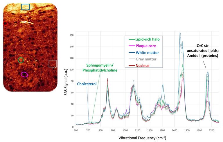 A aquisição de imagens espectroscópicas SRS fornece informações detalhadas sobre a composição química das estruturas cerebrais. Esquerda: Imagem de SRS mostrando estruturas saudáveis de matéria branca ricas em lipídios (parte superior) e depósitos de lipídios patológicos circundando uma placa de Amiloide-β (parte inferior esquerda). Direita: Os espectros de SRS mostram que os depósitos patológicos são enriquecidos com lipídios de membrana (esfingomielina, fosfatidilcolina) em comparação com a matéria branca mais rica em colesterol.