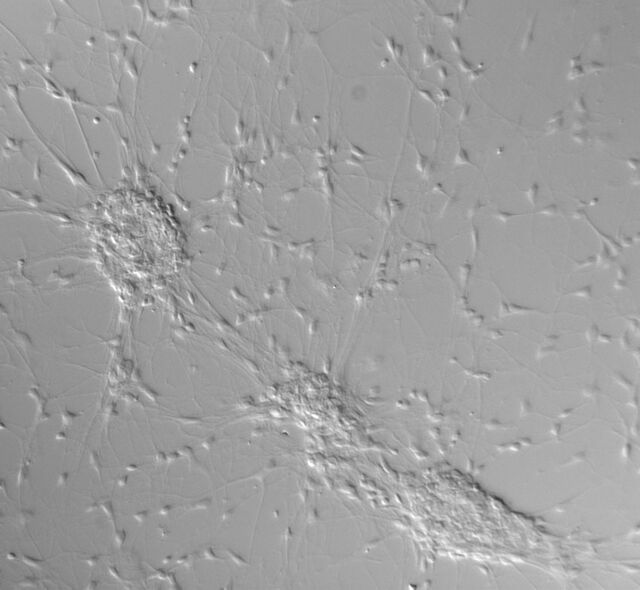 Differential interference contrast (DIC)