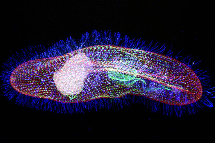 Protist Paramecium (Paramecium tetraurelia) stained to show the nucleus