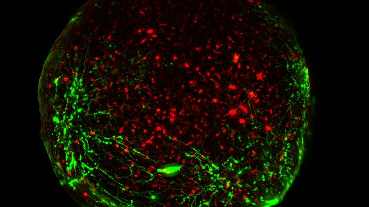 Virally labeled neurons (red) and astrocytes (green) in a cortical spheroid derived from human induced pluripotent stem cells. THUNDER Model Organism Imager with a 2x, 0.15 NA objective at 3.4x zoom was used to produce this 425 µm Z-stack (26 positions) which is presented here as an Extended Depth of Field (EDoF) projection. Images courtesy of Dr. F. Birey, Dr. S. Pasca laboratory, Palo Alto, CA.