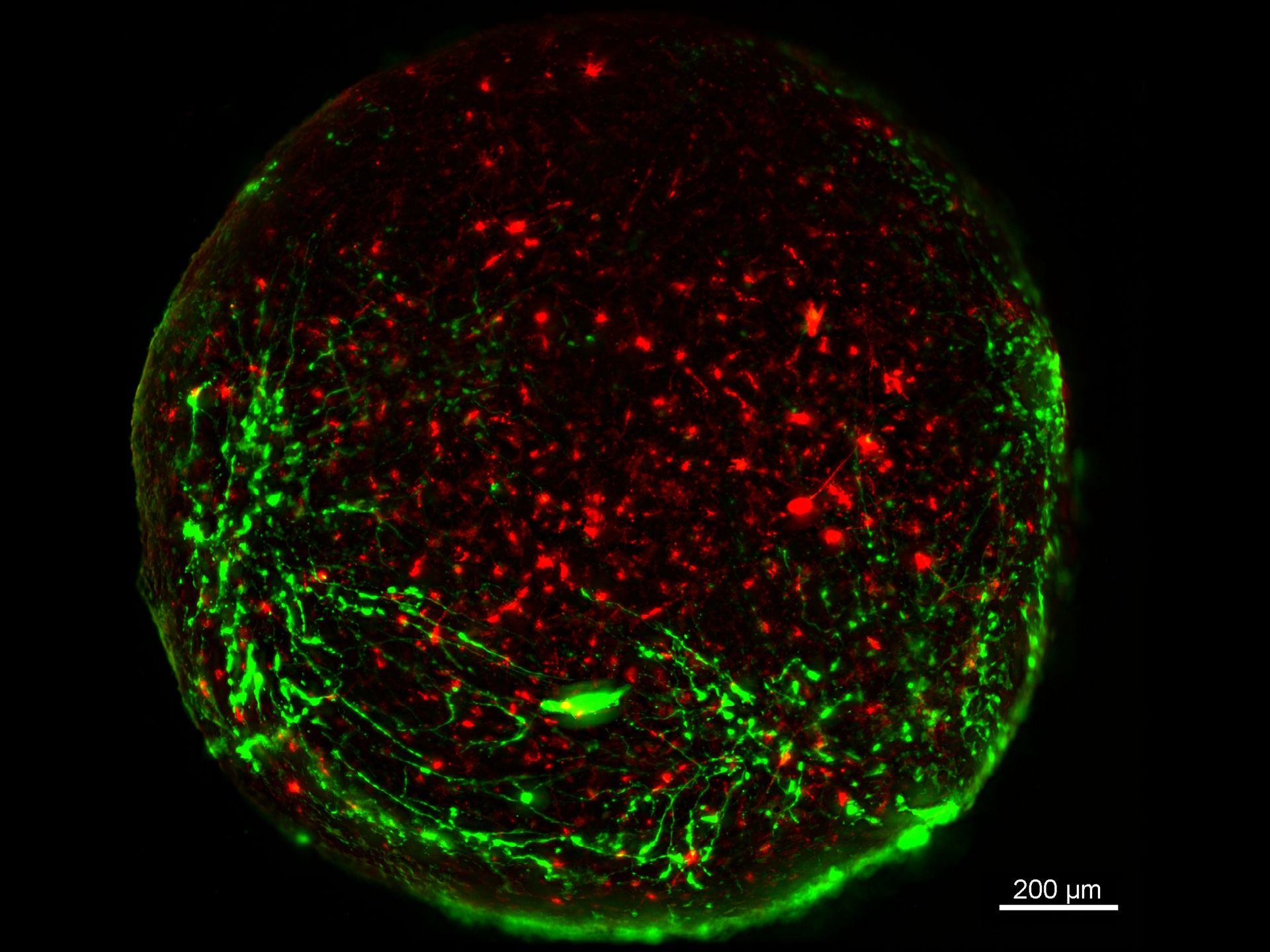 Virally labeled neurons (red) and astrocytes (green) in a cortical spheroid derived from human induced pluripotent stem cells. THUNDER Model Organism Imager with a 2x, 0.15 NA objective at 3.4x zoom was used to produce this 425 µm Z-stack (26 positions) which is presented here as an Extended Depth of Field (EDoF) projection. Images courtesy of Dr. F. Birey, Dr. S. Pasca laboratory, Palo Alto, CA.