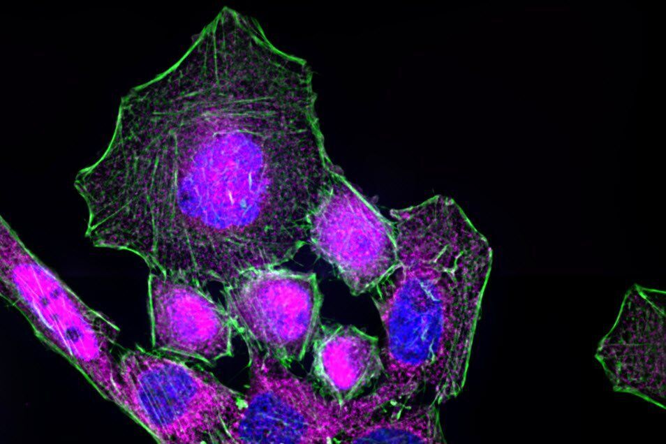 HeLa cells stimulated with LPS. Image has been subjected to deconvolution. HeLa_cells_stimulated_with_LPS_deconvolution.jpg