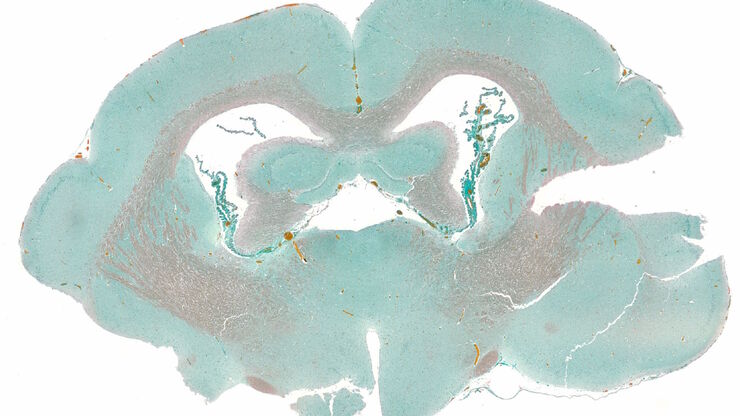 Masson-Goldner staining of a hedgehog brain slice. Masson-Goldner staining of a hedgehog brain slice.