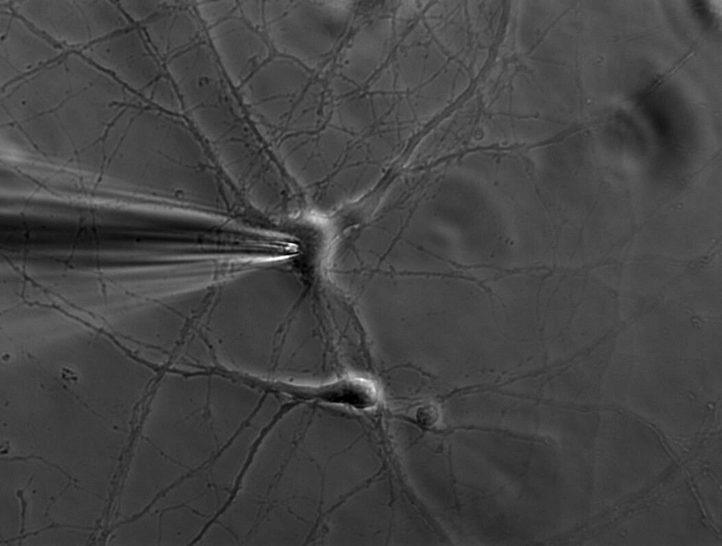  Murine_hippocampal_neuron_with_patch_pipette.jpg