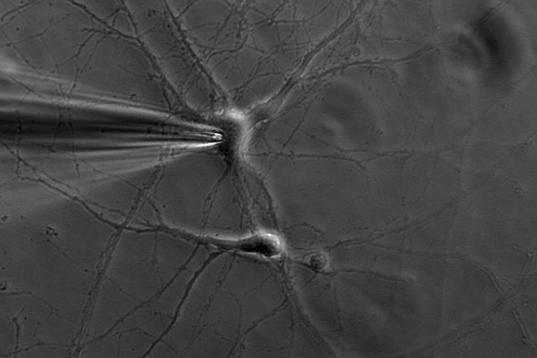 Patch pipette touching a murine hippocampal neuron. Image courtesy of A. Aguado, Ruhr University Bochum, Germany. Murine_hippocampal_neuron_with_patch_pipette.jpg