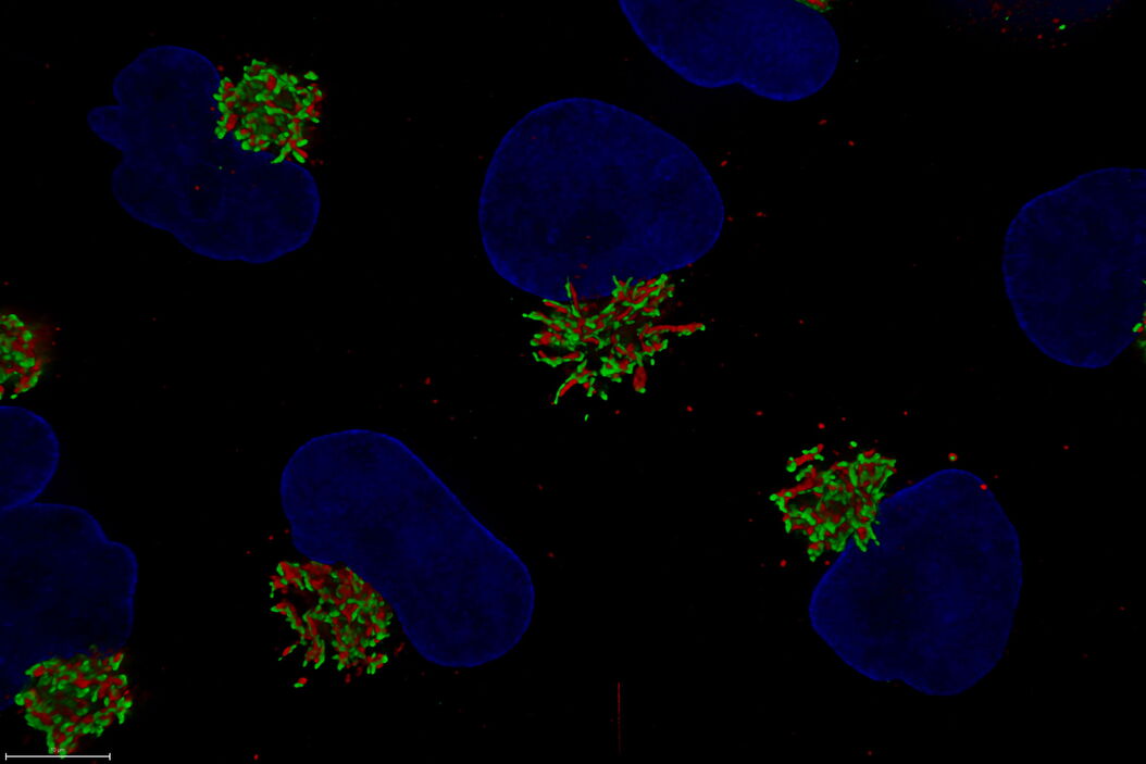 Untreated Hela Kyoto cells stained to show the nucleus (Hoechst, blue), the cis-golgi matrix protein GM130 (AF488, green), and the trans-golgi network membrane protein TGN46 (AF647, red).  Untreated_Hela_Kyoto_cells_acquired_on_Mica_using_THUNDER_grade_processing.jpg