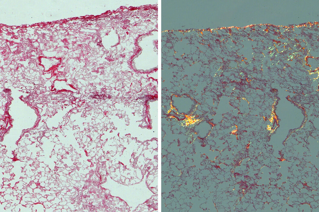 [Translate to chinese:] Mouse lung sections Studying_Pulmonary_Fibrosis_Teaser.jpg