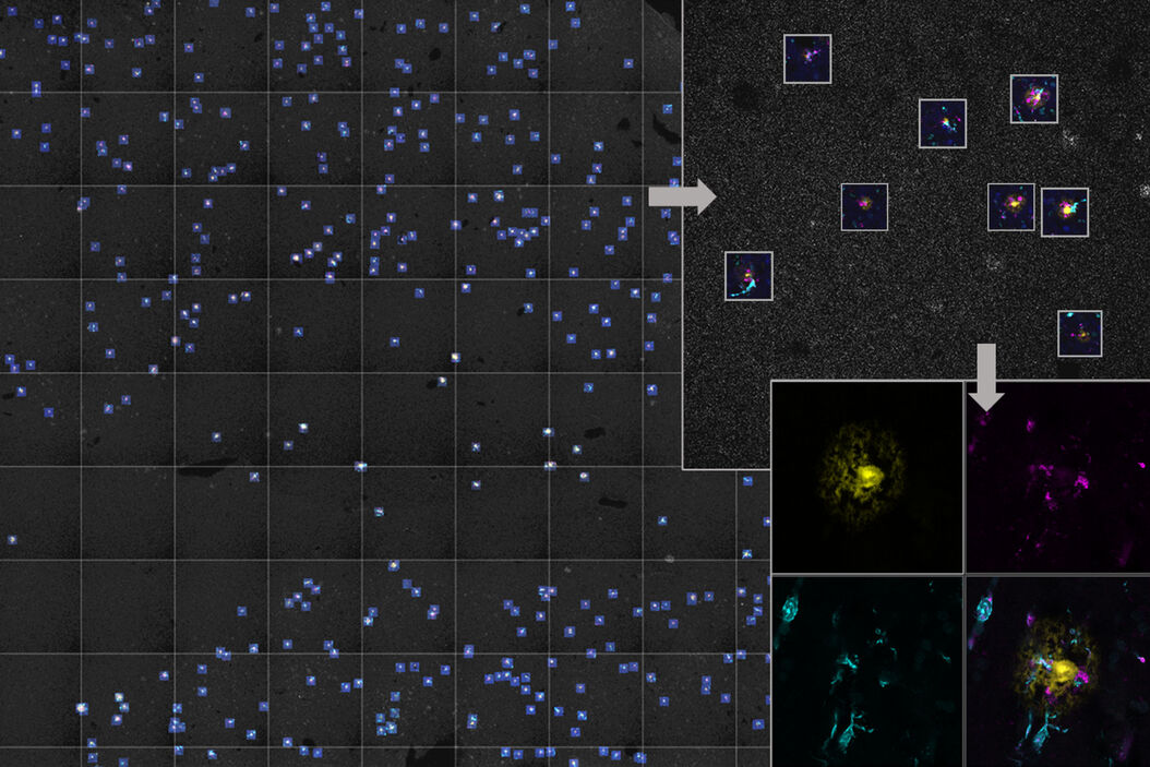 AI-based workflow for fast rare event detection in living biological samples using Autonomous Microscopy powered by Aivia AI-Workfow_rare-event-detection.jpg