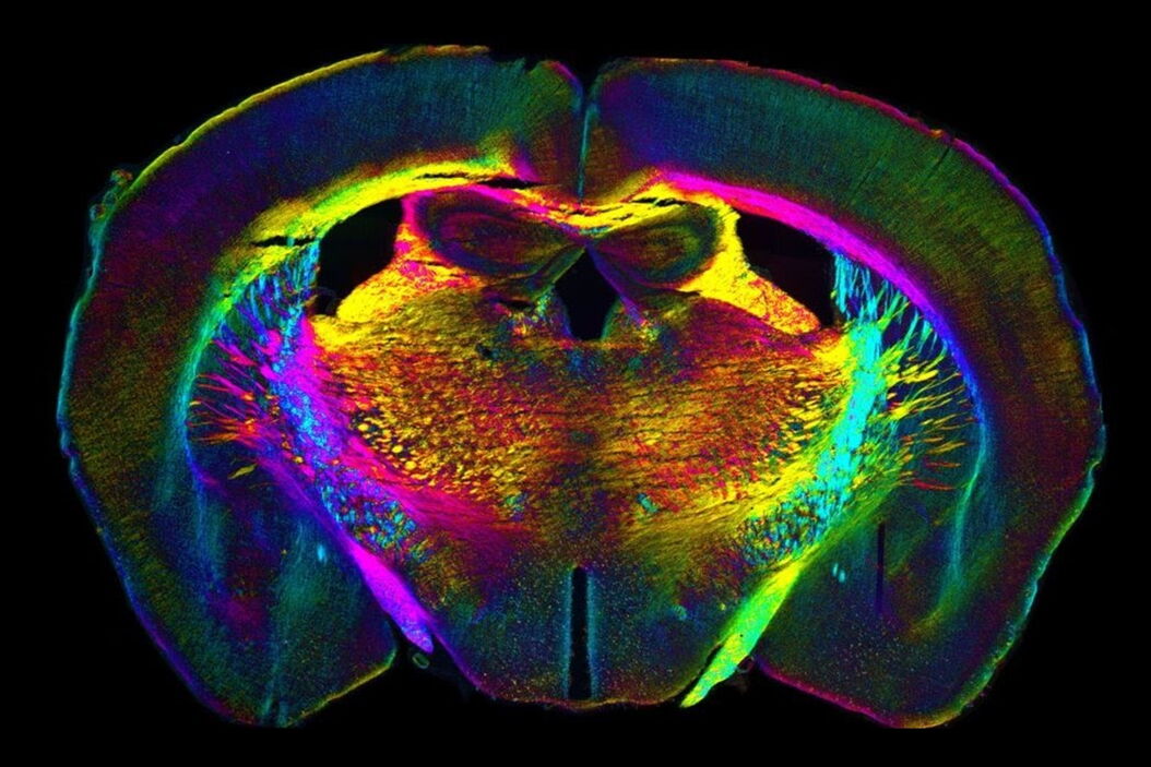 [Translate to chinese:] Analysis of anatomy and axon orientation of an adult mouse brain tissue with QLIPP Learning_the_Cellular_Architecture_from_its_Optical_Properties_teaser.jpg