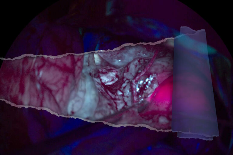 AR Fluorescence Application for Brain Tumor Surgery