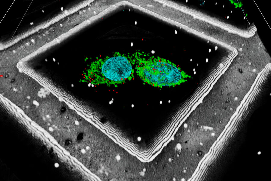 [Translate to chinese:] LNG-non-LNGHeLa cells labeled with light blue –Hoechst, Nuclei; green –MitoTracker Green, Mitochondria; red -Bodipy, lipid droplets. White – beads, Reflection mode – grid bars. Cells kindly provided by Ievgeniia Zagoriy, Mahamid Group, EMBL Heidelberg, Germany.