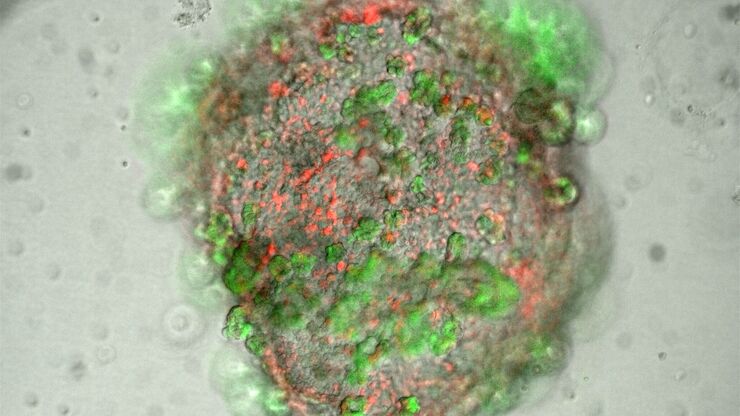 [Translate to chinese:] Lung organoid taken at the "liquid-air interface" with a THUNDER Imager 3D Cell Culture. The cells originate from transgenic mice, so that the different fluorescence represents the degree of differentiation of the respective cell (superposition). The image acquisition was performed on day 21 after the start of the culture. Reference: P. Kanrai, MPI-HLR Bad Nauheim.