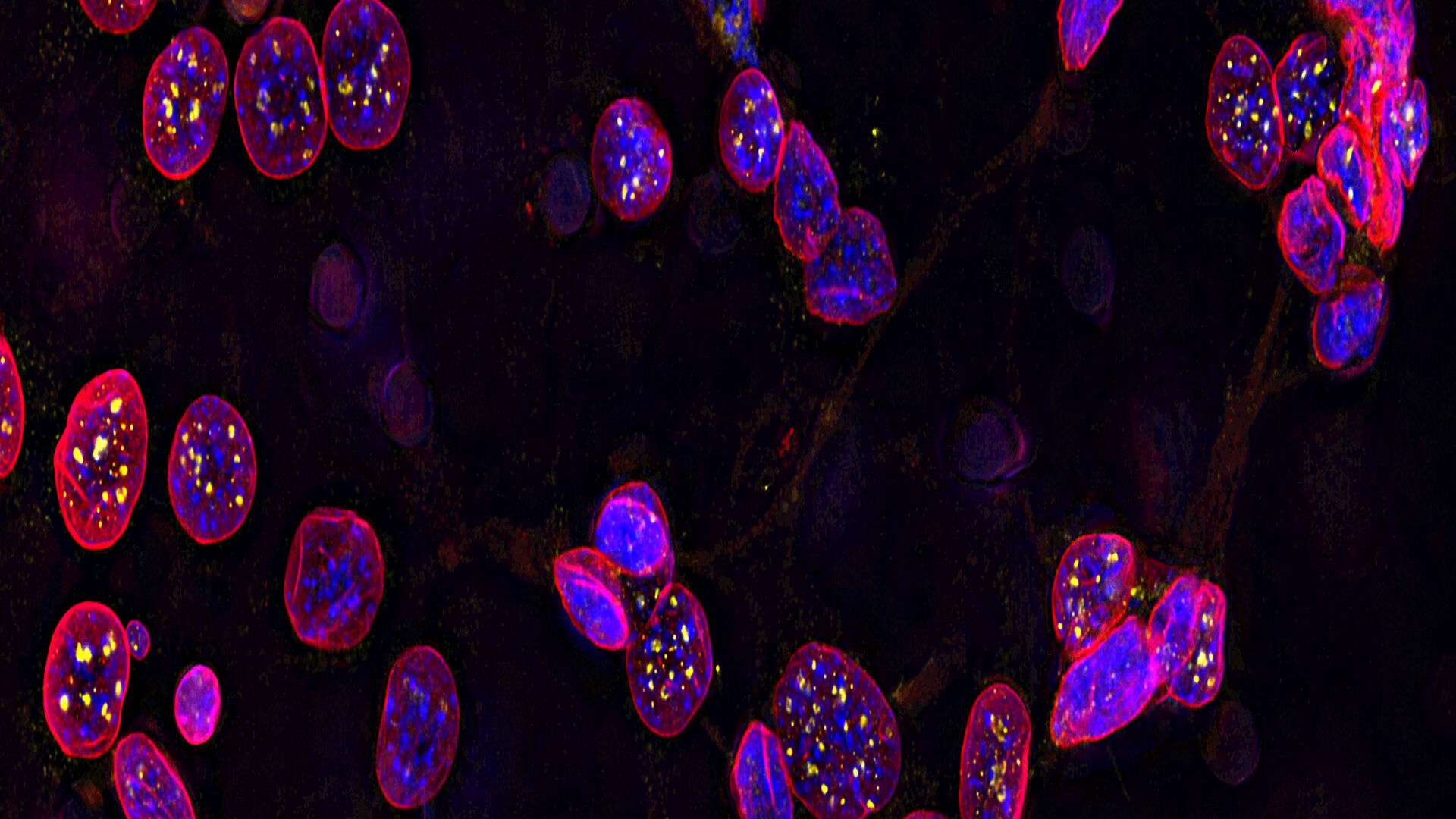 Image of C2C12 cells: The cells are stained with lamin B (magenta) which indicates nuclear structure, Hoechst (blue) indicating DNA, and γH2AX (yellow) indicating damage to DNA. Cells were imaged using a THUNDER Imager 3D Live Cell with a 63X/1.4 oil immersion objective.