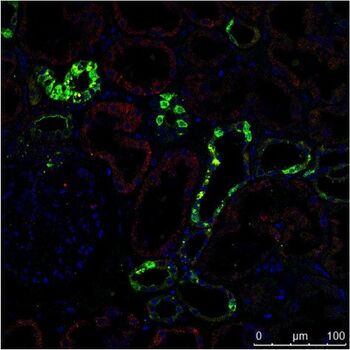 人类肾脏的免疫组织化学(IHC)染色在不同的结构中显示了不同的细胞类型（如肾小球、近曲小管、远曲小管）。