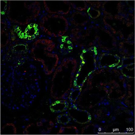 人类肾脏的免疫组织化学(IHC)染色在不同的结构中显示了不同的细胞类型（如肾小球、近曲小管、远曲小管）。