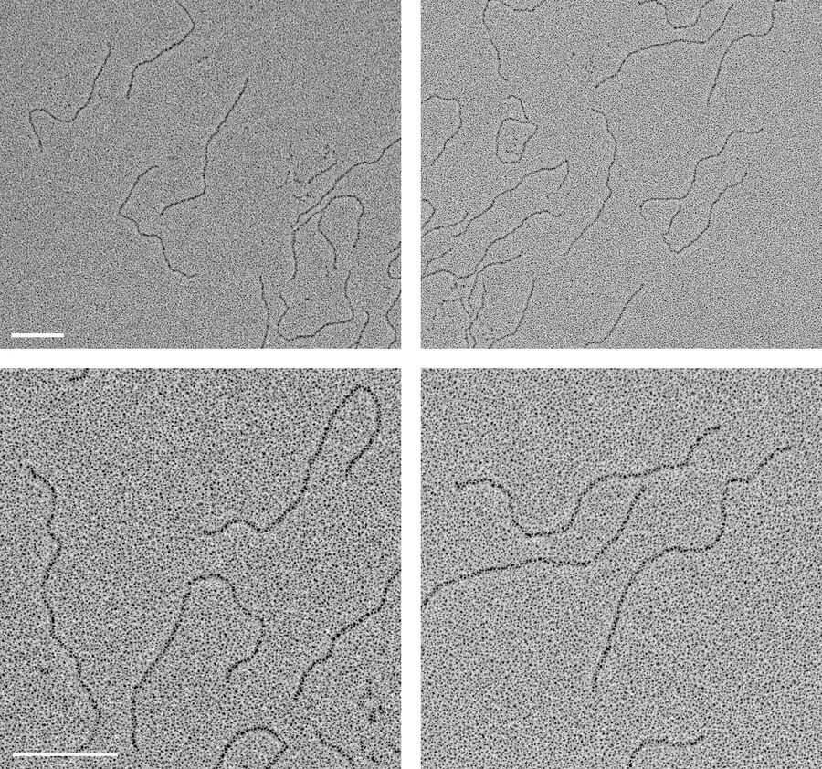 DNA prepared by low angle rotary shadowing as described in the text and visualized in the transmission electron microscope.