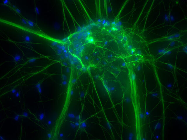 培养的皮层神经元 (宽场原始数据)