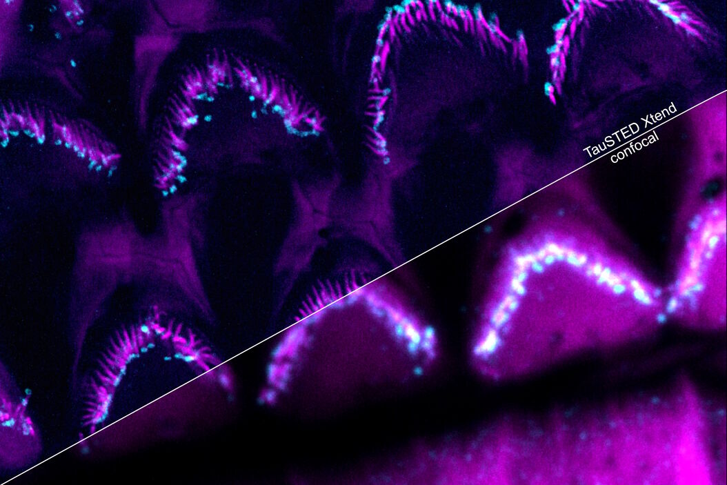 [Translate to chinese:] Multicolor fixed STED image. Inner ear section, mouse, TauSTED Xtend 589 on AF488 and TauSTED Xtend 775 on AF633-Phalloidin. Sample courtesy of Dennis Derstrof, Klinik für Hals-, Nasen und Ohrenheilkunde, Universität Marburg & Prof. Dr. Dominik Oliver aus dem Institut für Physiologie und Pathophysiologie, Abteilung für Neurophysiologie, Universität Marburg. Inner_ear_section_mouse_multicolor_fixed_TauSTED_Xtend.jpg