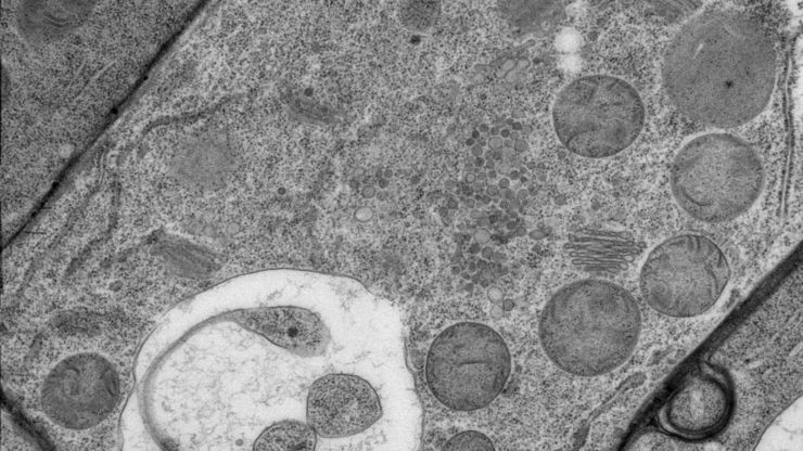 Arabidopsis thaliana. Courtesy of Riet De Rycke, University of Ghent, Belgium. 