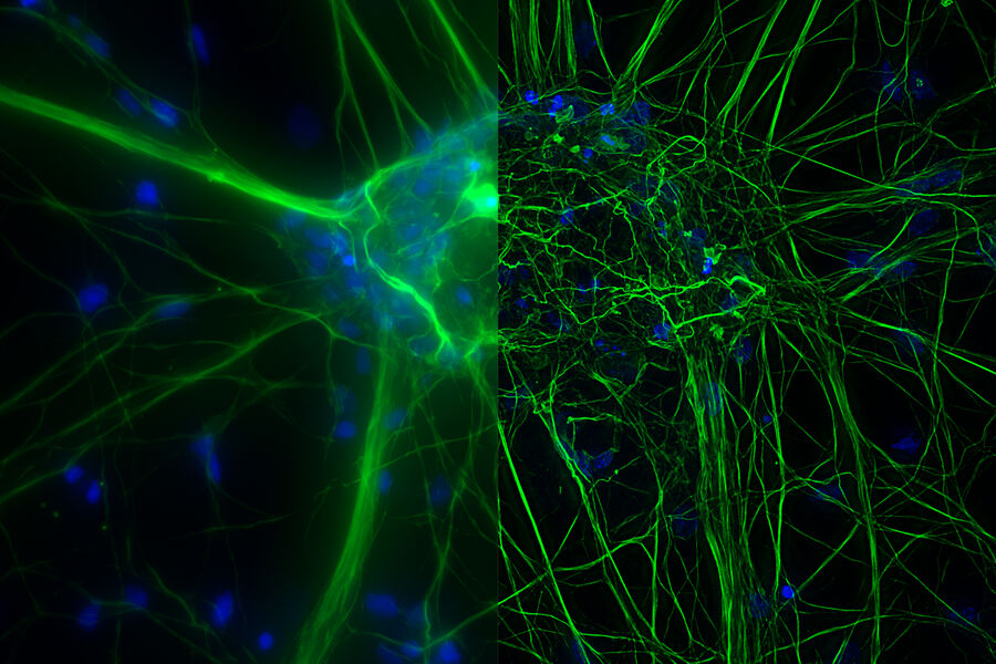 Cultured cortical neurons where green indicates beta-III-tubulin and blue nuclei. The slider shows a raw widefield image compared to one with Large Volume Computational Clearing (LVCC). An image stack of 59 planes was acquired using a THUNDER Imager 3D Cell Culture microscope. Sample courtesy of FAN GmbH, Magdeburg, Germany.