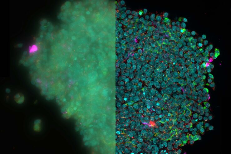 3D reconstruction of an isolated human islet