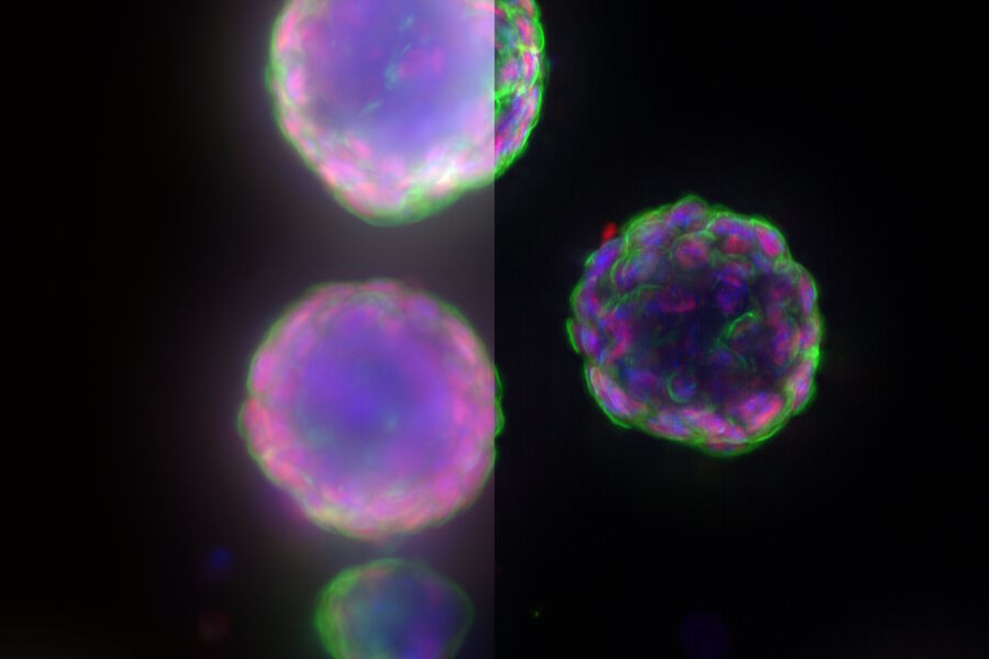使用THUNDER Imager 3D Cell Culture成像仪拍摄的小鼠食管器官组织。Integrin alpha6（AlexaFluor 488，绿色），Sox2（AlexaFluor 568，红色），细胞核（Dapi，蓝色）。样本由芬兰坦佩雷大学 Fabio Tadeu Arroso Martins 博士提供。样本拍摄成像由 Immuno Diagnostic Oy 的 Janne Ylärinne 博士提供。