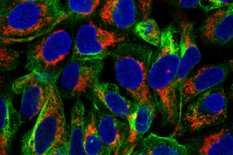 用 DAPI（细胞核，蓝色）、抗-α-tubulin-ATO 488（微管，绿色）和抗-TOMM20-ATO 643（线粒体，红色）染色的 U2OS 人骨肉瘤细胞。图像采用共聚焦显微镜拍摄。