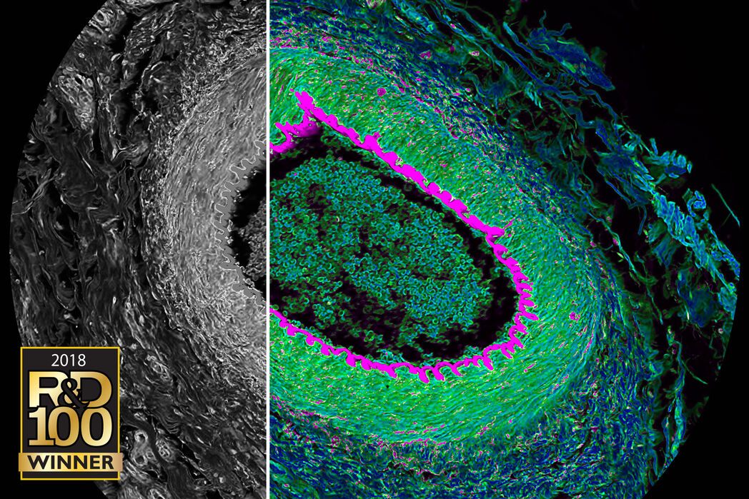 Corte histológico de un ojo de gato. Imágenes confocales espectrales simultaneas (gris) y FLIM (color) revela el contraste de tiempo de vida. Adquisición y visualización mediante SP8 FALCON y software LAS X.