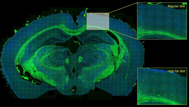 Obtención automatizada de imágenes de muestras de gran superficie: Aquí se muestra un barrido de mosaico de alta resolución de un corte cerebral completo de ratón. Una comparación de las regiones del tejido cortical correspondientes a partir de ratones criados en una dieta con alto contenido en grasa frente a una dieta normal revela la aparición de placas arteriales patológicas ricas en lípidos en una dieta con alto contenido en grasa, pero no en una dieta regular. Muestra por cortesía de Judith Leyh y el Prof. Ingo Bechmann, Universität Leipzig, Alemania.