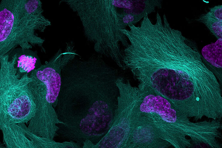 活细胞成像图库 | 显微镜知识库 | 徕卡显微系统