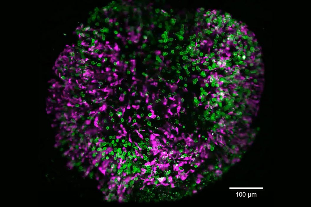 Brain organoid labeled with lamin (green) and tubulin (magenta), acquired using Viventis Deep. Courtesy of Akanksha Jain, Treutlein Lab ETH-DBSSE Basel (Switzerland). Brain_organoid_Viventis_Deep.jpg
