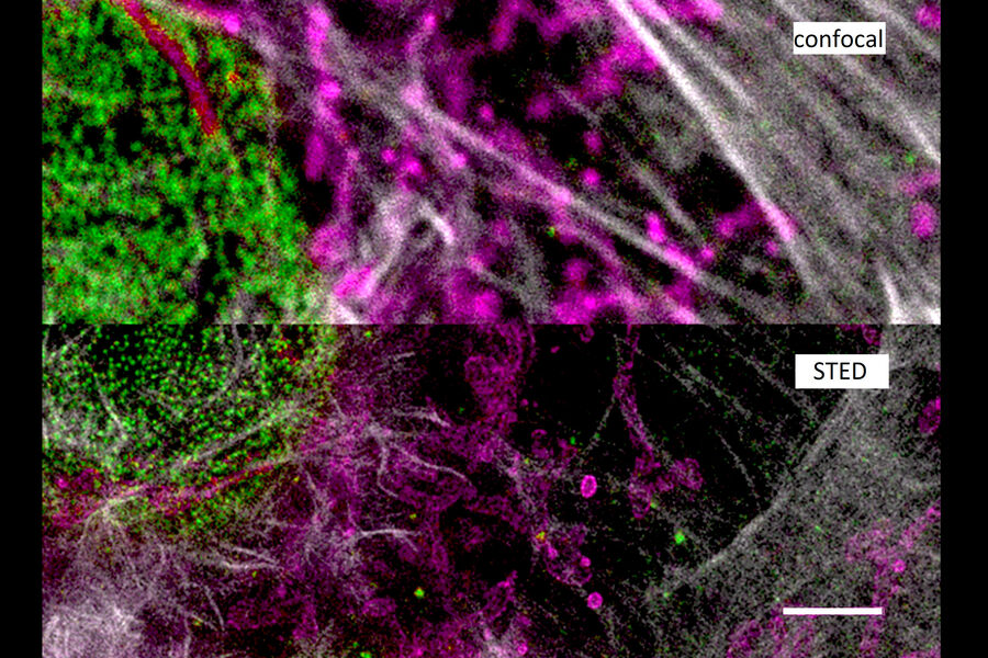 Three color STED imaging of Cos 7 cells