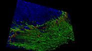 Image: Human stem cell-derived mid brain organoids. Courtesy of Dr Tanya Singh, University of Oxford. 