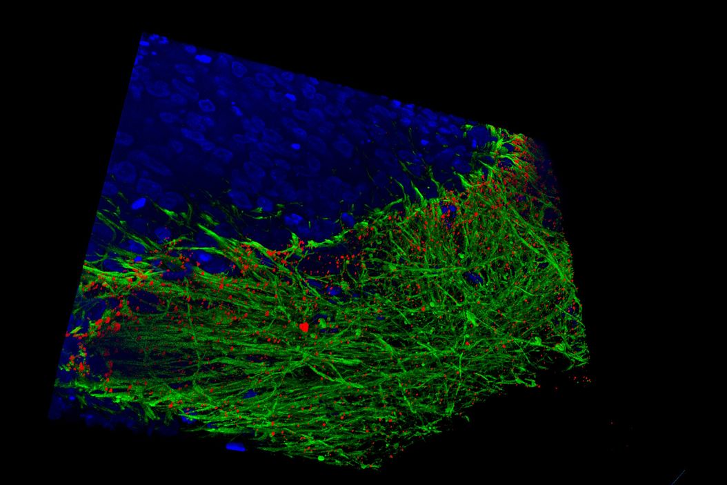 Image: Human stem cell-derived mid brain organoids. Courtesy of Dr Tanya Singh, University of Oxford. Image: Human stem cell-derived mid brain organoids. Courtesy of Dr Tanya Singh, University of Oxford. 3D_human_bladder_microtissue_infected_with_E_coli.jpg