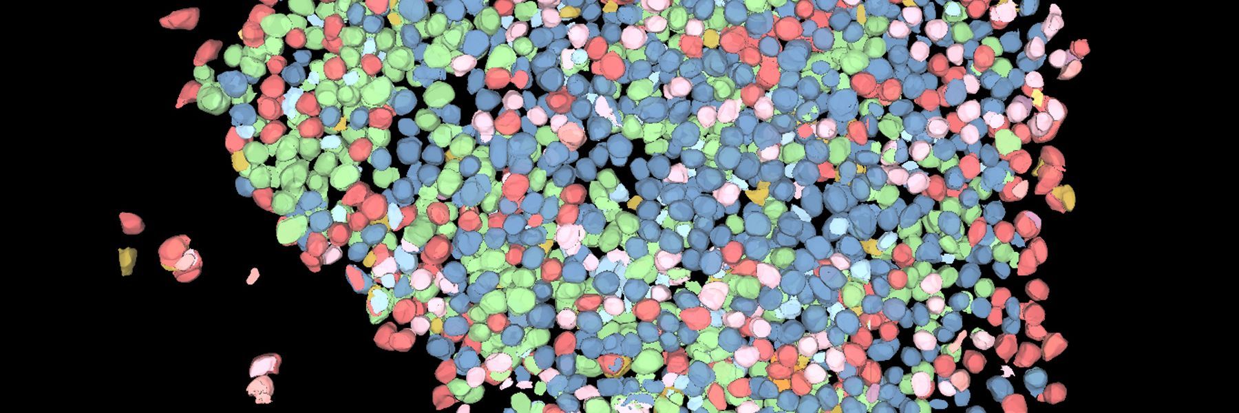 经大容量计算清除处理的人体胰岛器官雷图像。 