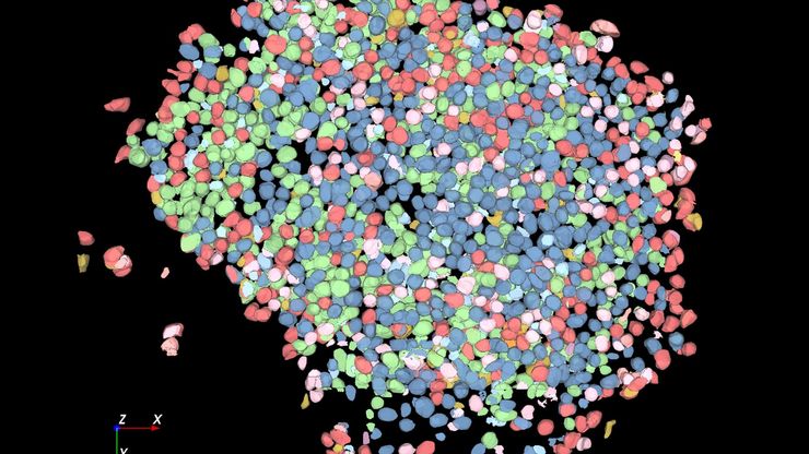 经大容量计算清除处理的人体胰岛器官雷图像。 