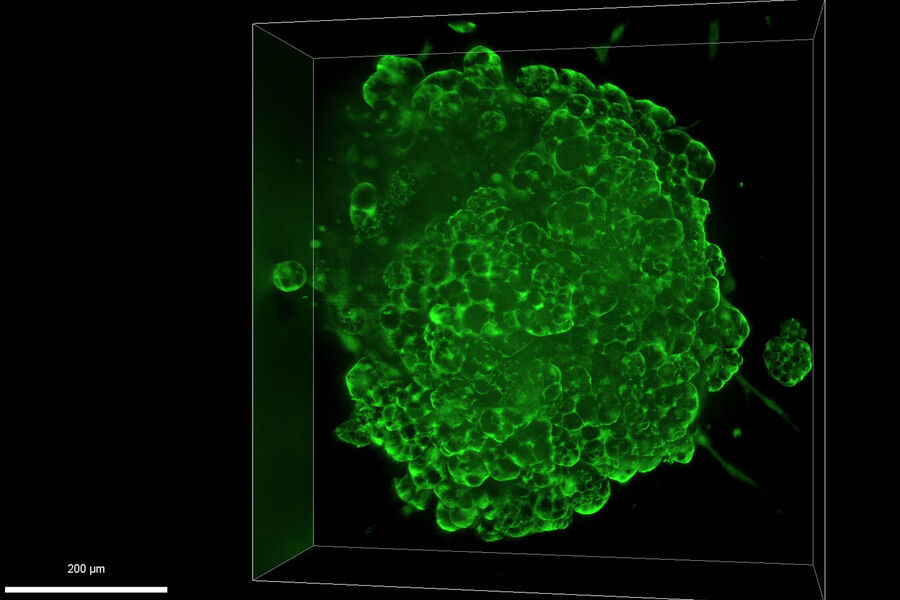 Mouse lung organoids derived from alveola stem and progenitor cells. Sample courtesy Dr. Pumaree Kanrai, MPI for Heart and Lung Research, Bad Nauheim (Germany). 