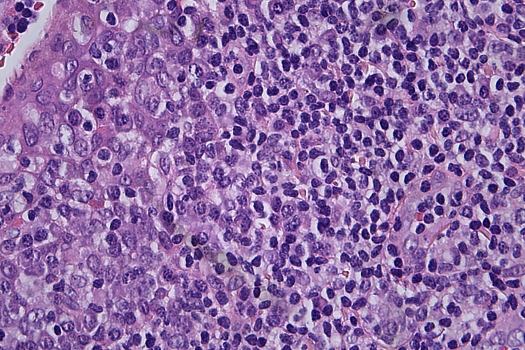 Histopathological sample, 40x magnification Sample_histopathology_40x.jpg