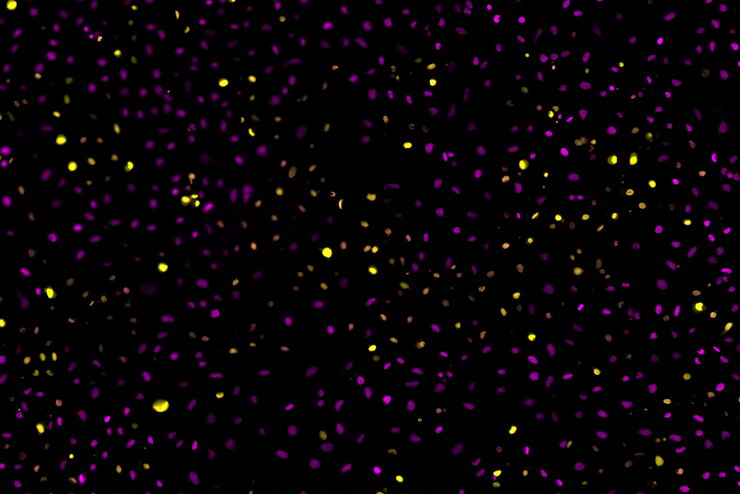 Two-color caspase assay with tile scan. U2OS cells were treated with the nuclear marker DRAQ5 (magenta) and CellEvent™ (yellow).